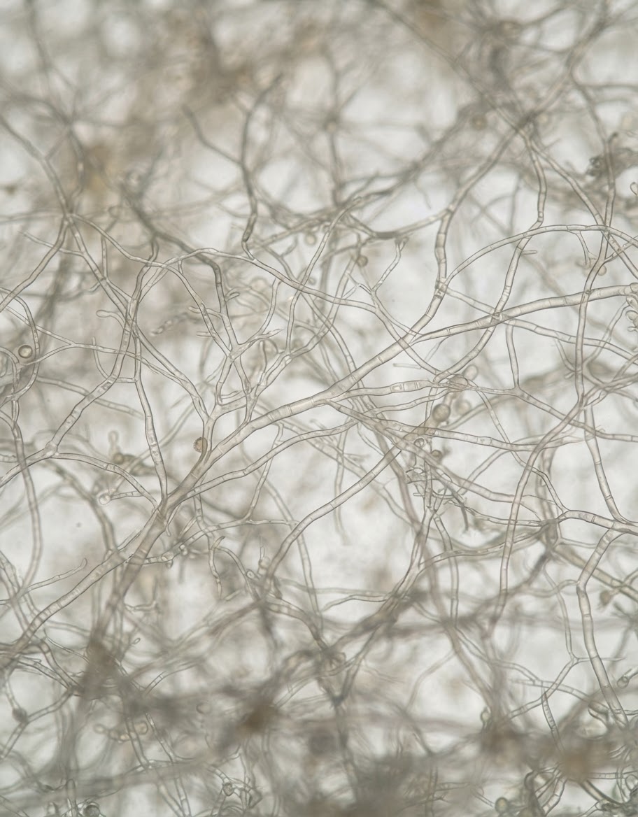 Muundo wa microscopic wa mycelium, mtandao wa nyuzi za kuvu unaounda mycoprotein.
